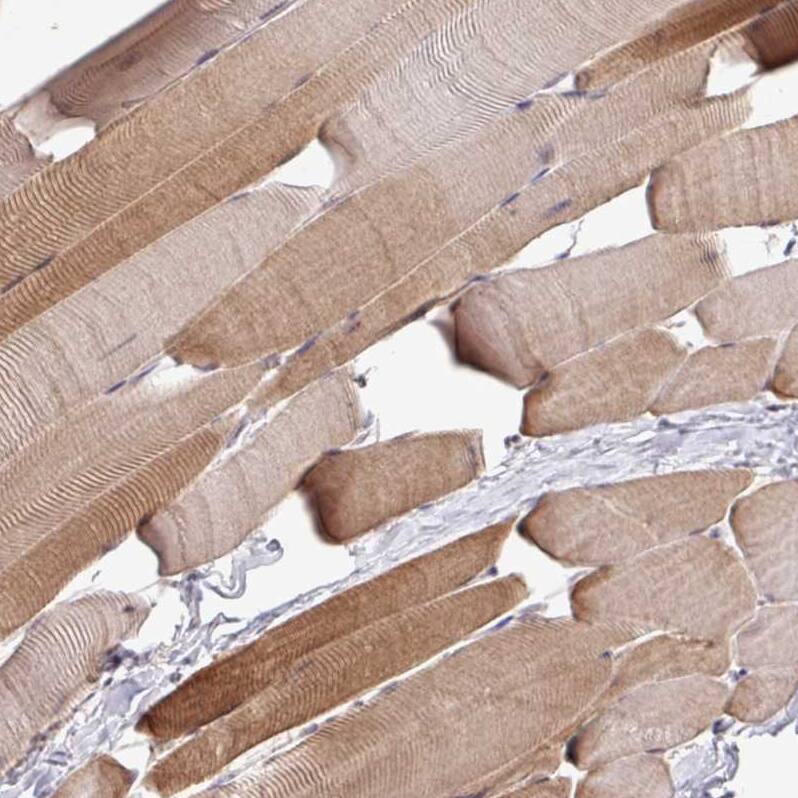 RPP25L Antibody - BSA Free Immunohistochemistry: RPP25L Antibody - BSA Free [NBP2-13259]