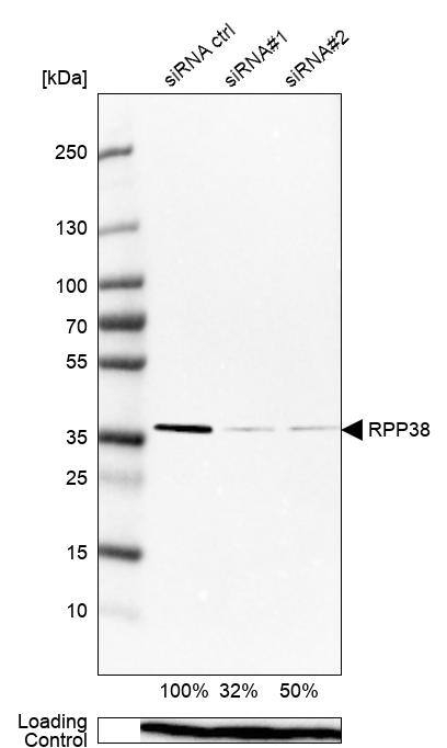 RPP38 Antibody - BSA Free Western Blot: RPP38 Antibody - BSA Free [NBP2-13260]