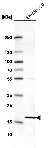RPS18 Antibody - BSA Free Western Blot: RPS18 Antibody - BSA Free [NBP2-13263]