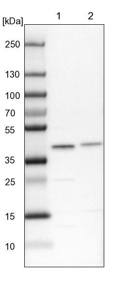 SUMO Activating Enzyme E1 (SAE1) Antibody - BSA Free Western Blot: SUMO Activating Enzyme E1 (SAE1) Antibody - BSA Free [NBP2-13272]