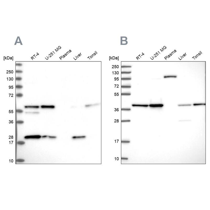 SUMO Activating Enzyme E1 (SAE1) Antibody - BSA Free Western Blot: SUMO Activating Enzyme E1 (SAE1) Antibody - BSA Free [NBP2-13272]