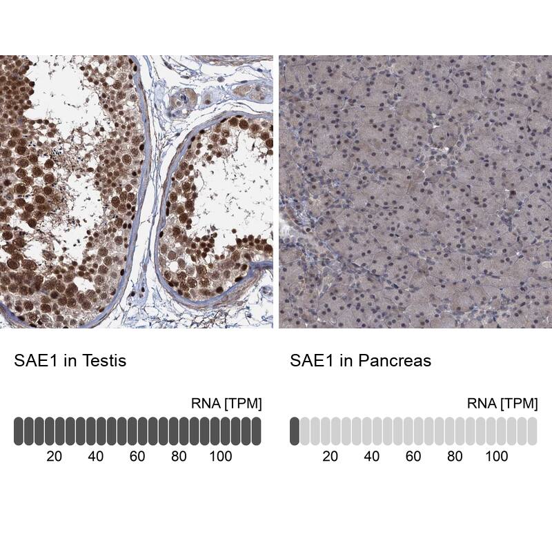 SUMO Activating Enzyme E1 (SAE1) Antibody - BSA Free Immunohistochemistry: SUMO Activating Enzyme E1 (SAE1) Antibody - BSA Free [NBP2-13272]