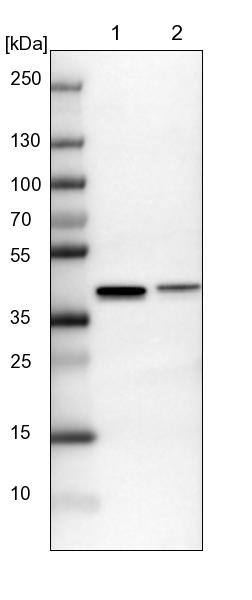SUMO Activating Enzyme E1 (SAE1) Antibody - BSA Free Western Blot: SUMO Activating Enzyme E1 (SAE1) Antibody - BSA Free [NBP2-13273]