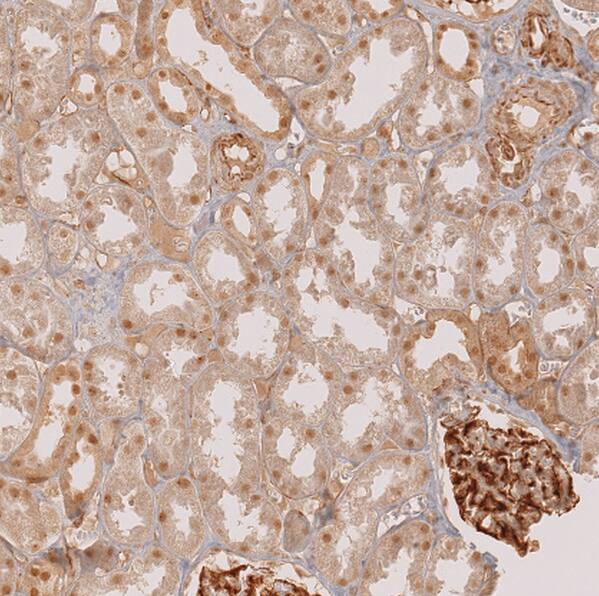 SALL1 Antibody - BSA Free Immunohistochemistry: SALL1 Antibody - BSA Free [NBP2-13275]