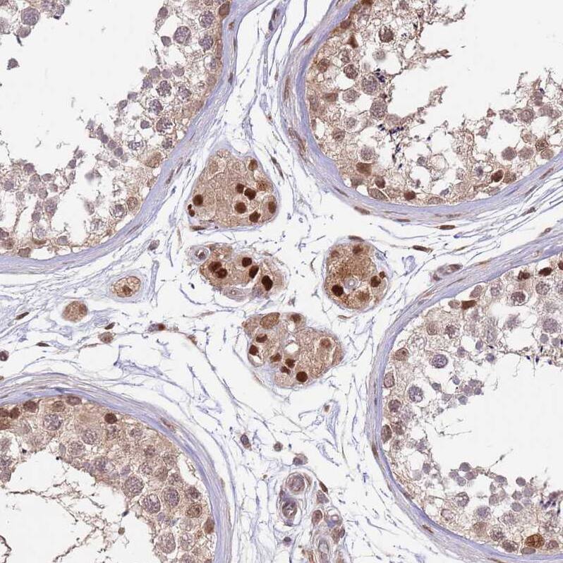 SALL1 Antibody - BSA Free Immunohistochemistry: SALL1 Antibody - BSA Free [NBP2-13275]