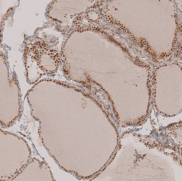 SALL1 Antibody - BSA Free Immunohistochemistry: SALL1 Antibody - BSA Free [NBP2-13275]
