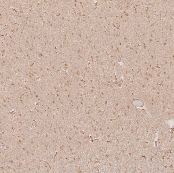 SALL1 Antibody - BSA Free Immunohistochemistry: SALL1 Antibody - BSA Free [NBP2-13275]