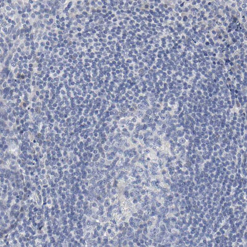 SALL2 Antibody - BSA Free Immunohistochemistry: SALL2 Antibody - BSA Free [NBP2-13276]