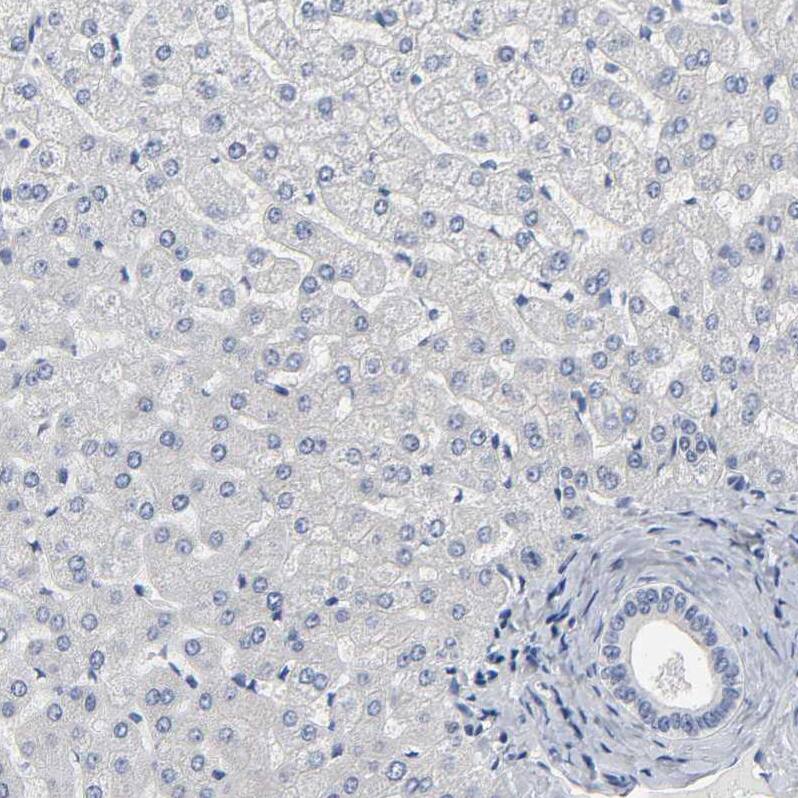 SALL2 Antibody - BSA Free Immunohistochemistry: SALL2 Antibody - BSA Free [NBP2-13276]