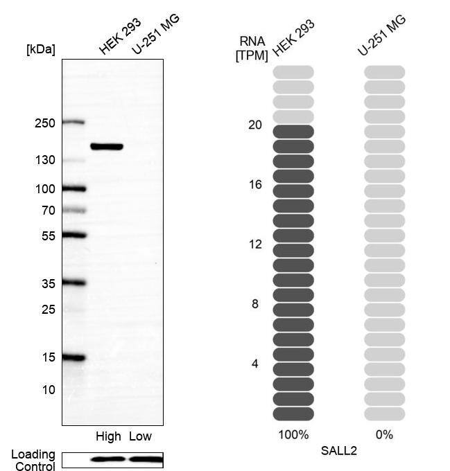 SALL2 Antibody - BSA Free Western Blot: SALL2 Antibody - BSA Free [NBP2-13276]