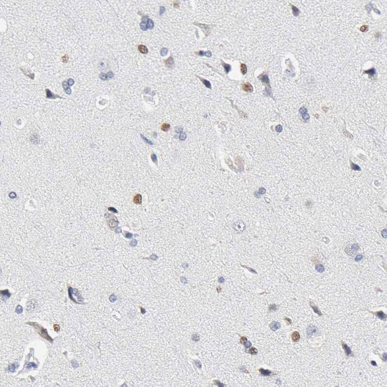 SALL2 Antibody - BSA Free Immunohistochemistry: SALL2 Antibody - BSA Free [NBP2-13276]