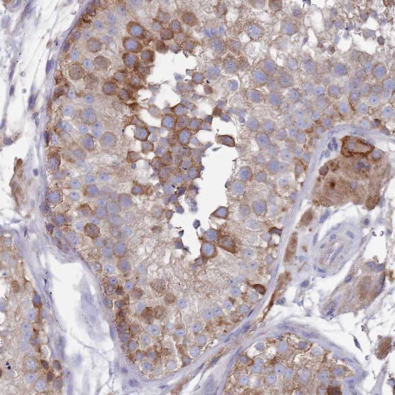 SCAPER Antibody - BSA Free Immunohistochemistry: SCAPER Antibody - BSA Free [NBP2-13285]