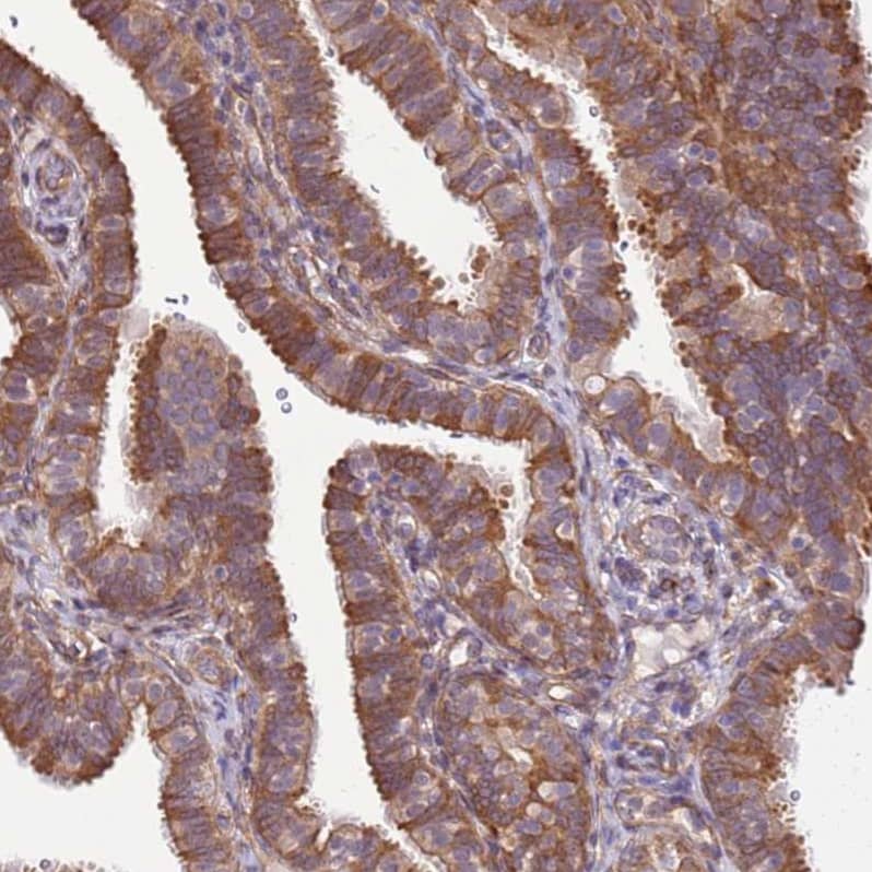 SCARA3 Antibody - BSA Free Immunohistochemistry: SCARA3 Antibody - BSA Free [NBP2-13286]