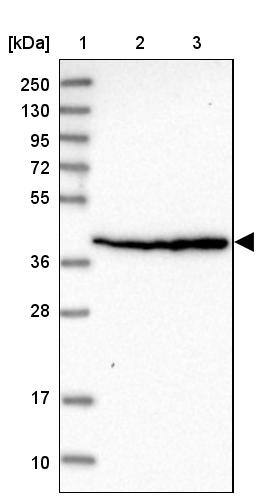 SCARA3 Antibody - BSA Free Western Blot: SCARA3 Antibody - BSA Free [NBP2-13286]
