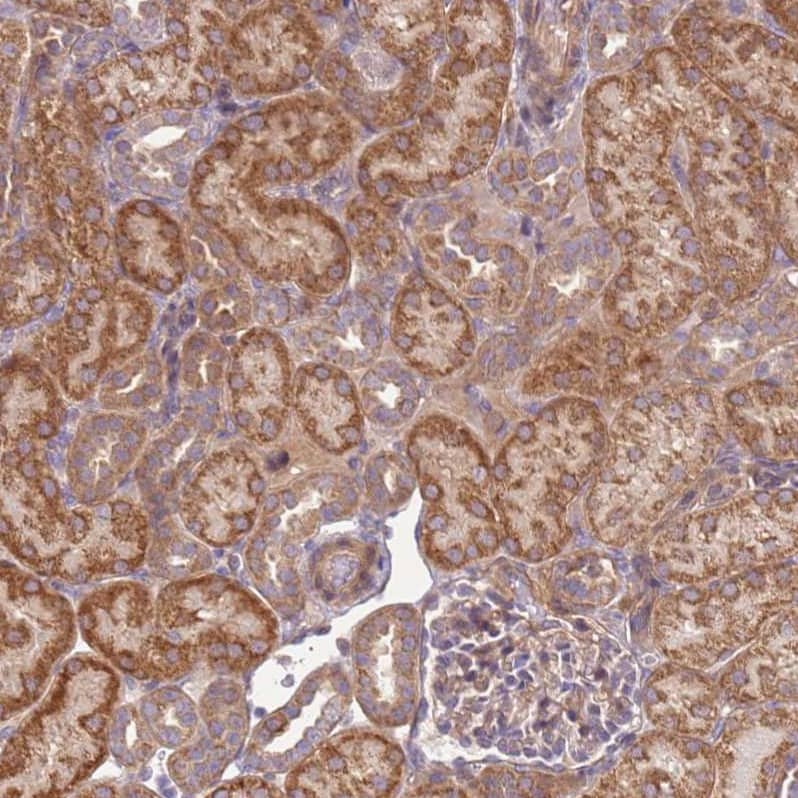 SCARA3 Antibody - BSA Free Immunohistochemistry: SCARA3 Antibody - BSA Free [NBP2-13286]