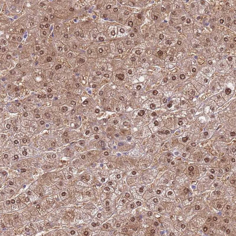 SEPHS2 Antibody - BSA Free Immunohistochemistry: SEPHS2 Antibody - BSA Free [NBP2-13293]