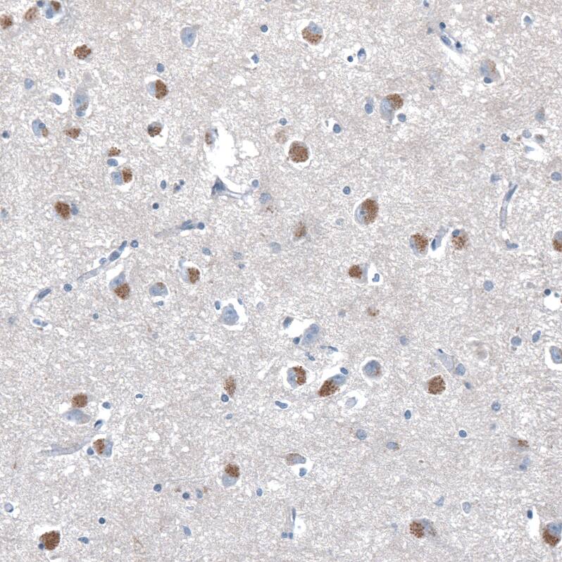 SERINC3 Antibody - BSA Free Immunohistochemistry: SERINC3 Antibody - BSA Free [NBP2-13296]