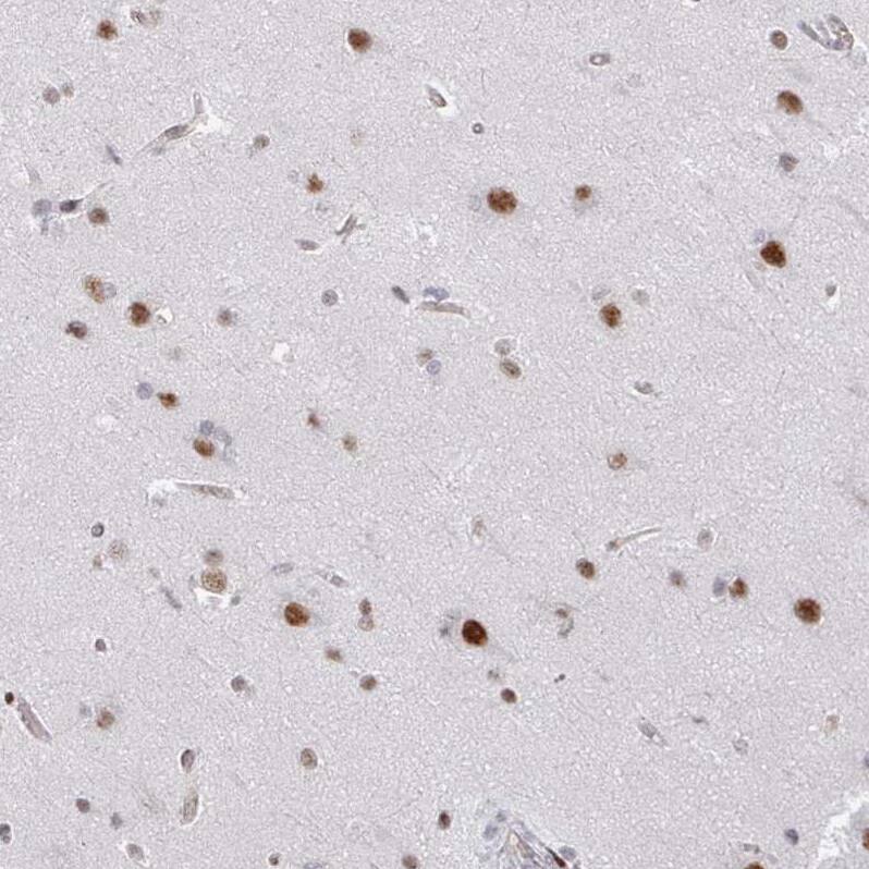 SF3B5 Antibody - BSA Free Immunohistochemistry: SF3B5 Antibody - BSA Free [NBP2-13301]