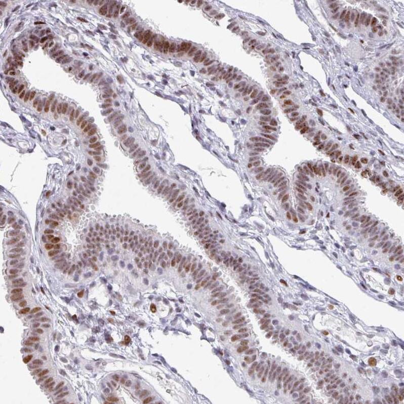 SF3B5 Antibody - BSA Free Immunohistochemistry: SF3B5 Antibody - BSA Free [NBP2-13301]