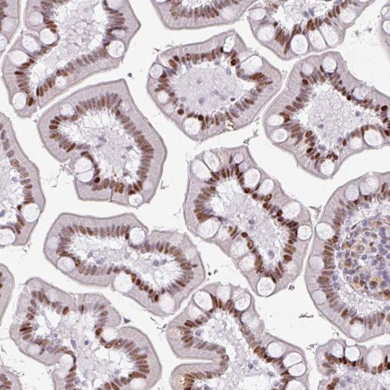 SF3B5 Antibody - BSA Free Immunohistochemistry: SF3B5 Antibody - BSA Free [NBP2-13301]