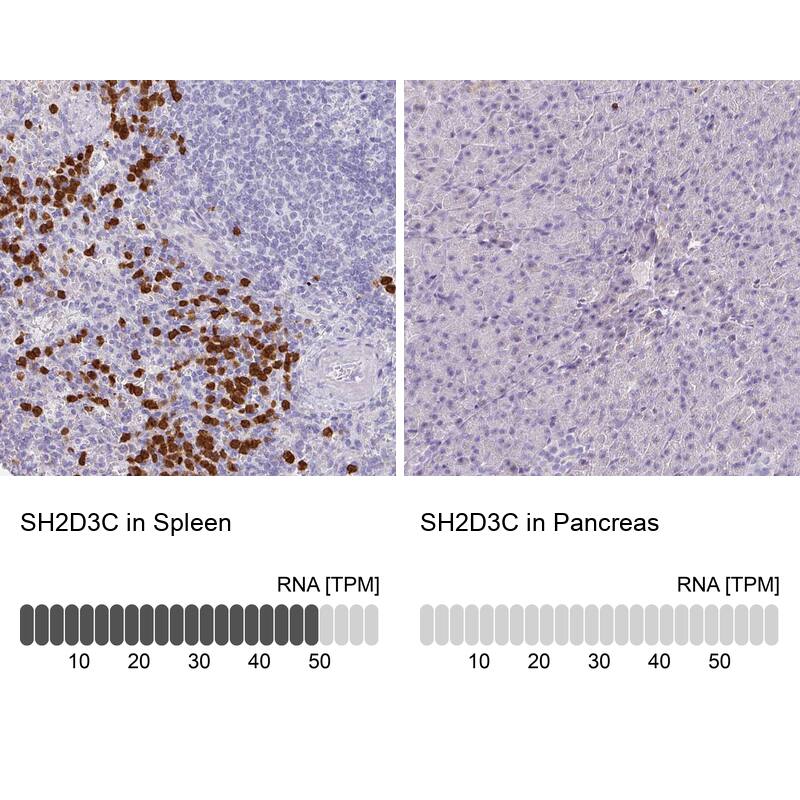 SH2D3C Antibody - BSA Free Immunohistochemistry: SH2D3C Antibody - BSA Free [NBP2-13306]