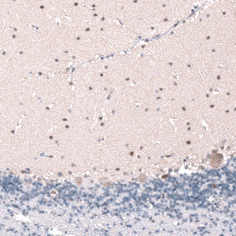SHC3 Antibody - BSA Free Immunohistochemistry: SHC3 Antibody - BSA Free [NBP2-13307]