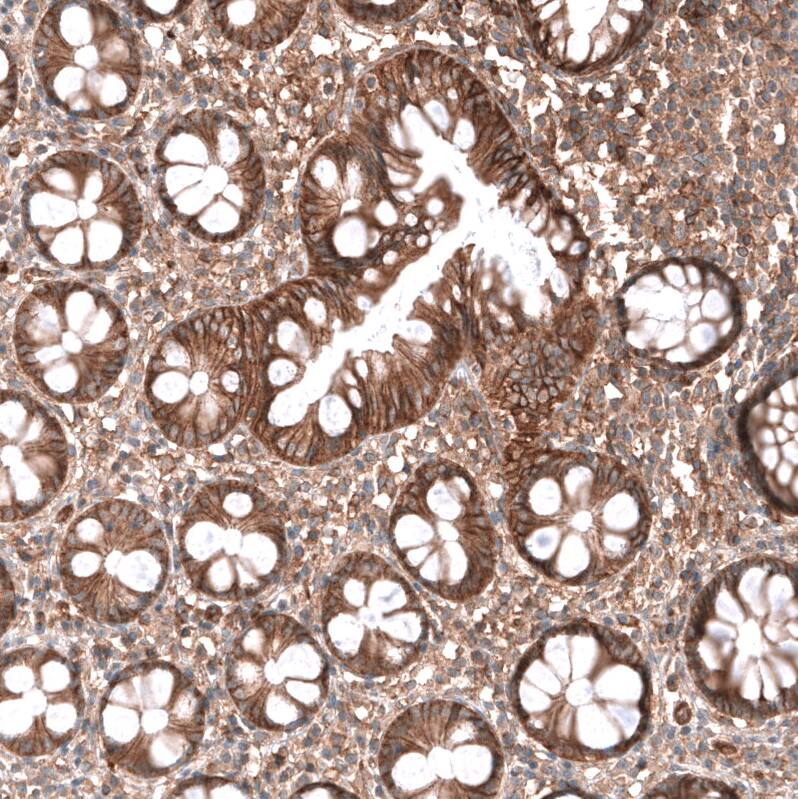 SHC3 Antibody - BSA Free Immunohistochemistry: SHC3 Antibody - BSA Free [NBP2-13307]