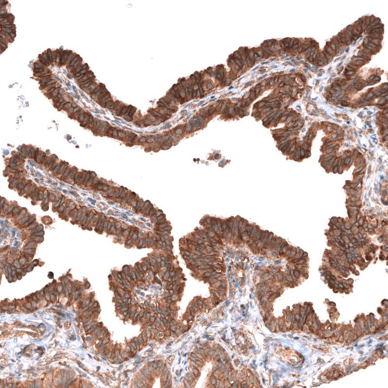 SHC3 Antibody - BSA Free Immunohistochemistry: SHC3 Antibody - BSA Free [NBP2-13307]