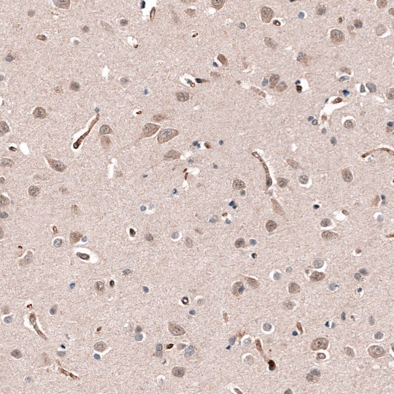 SHC3 Antibody - BSA Free Immunohistochemistry: SHC3 Antibody - BSA Free [NBP2-13307]