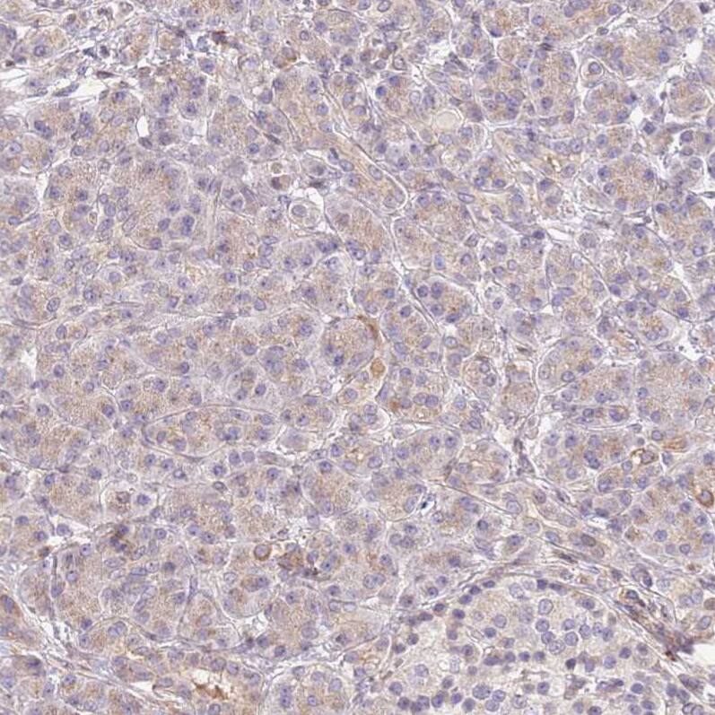 SLC16A4 Antibody - BSA Free Immunohistochemistry: SLC16A4 Antibody - BSA Free [NBP2-13315]