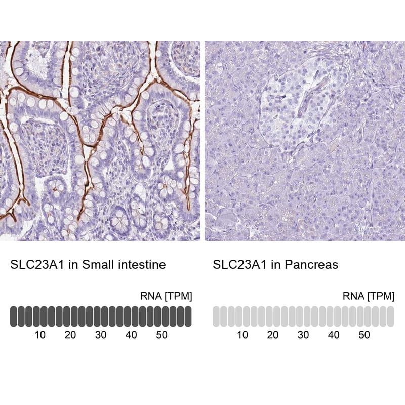 SLC23A1 Antibody - BSA Free Immunohistochemistry: SLC23A1 Antibody - BSA Free [NBP2-13318]