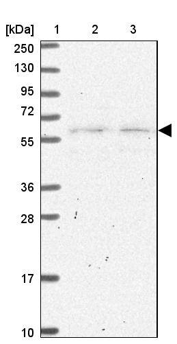SLC25A23 Antibody - BSA Free Western Blot: SLC25A23 Antibody - BSA Free [NBP2-13321]