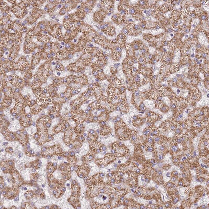 SLC25A42 Antibody - BSA Free Immunohistochemistry: SLC25A42 Antibody - BSA Free [NBP2-13325]