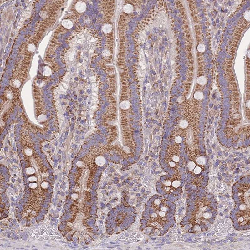 SLC25A42 Antibody - BSA Free Immunohistochemistry: SLC25A42 Antibody - BSA Free [NBP2-13325]