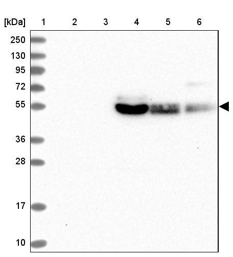 GLUT10 Antibody - BSA Free Western Blot: GLUT10 Antibody - BSA Free [NBP2-13326]