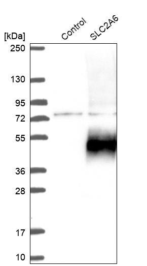 Glucose Transporter GLUT6 Antibody - BSA Free Western Blot: Glucose Transporter GLUT6 Antibody - BSA Free [NBP2-13327]
