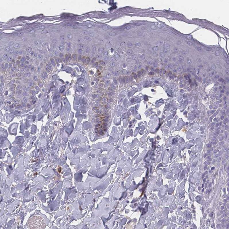 SLC35E4 Antibody - BSA Free Immunohistochemistry: SLC35E4 Antibody - BSA Free [NBP2-13330]