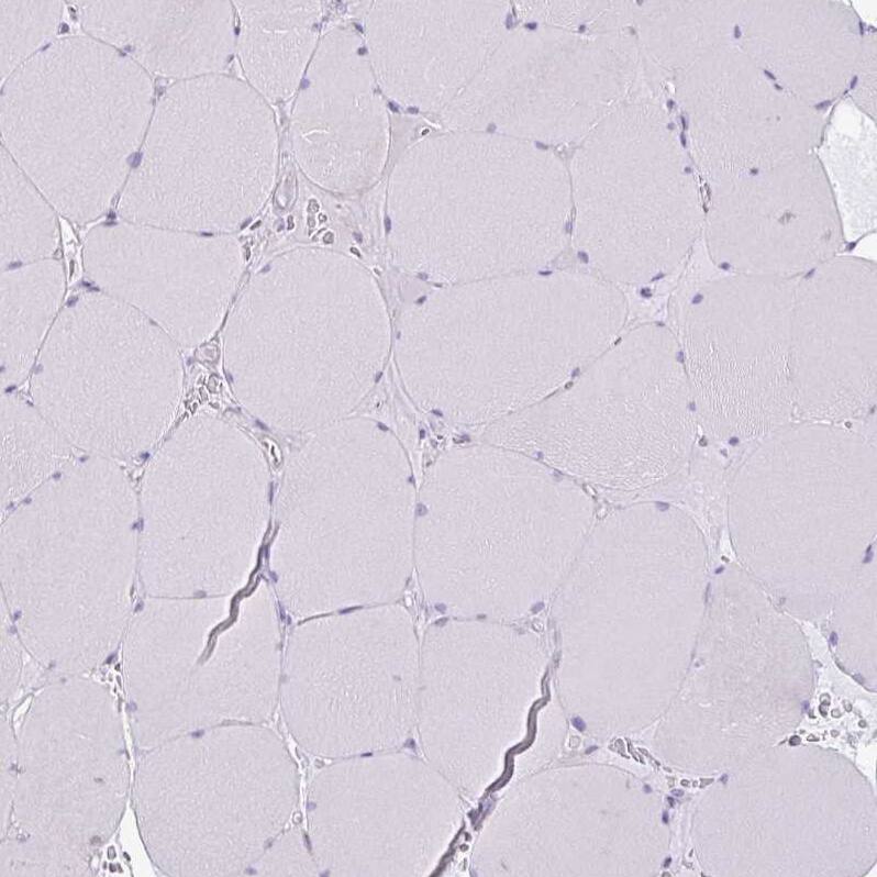 SLC38A1 Antibody - BSA Free Immunohistochemistry: SLC38A1 Antibody - BSA Free [NBP2-13336]