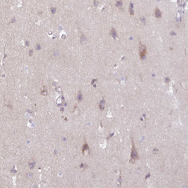 SLC38A1 Antibody - BSA Free Immunohistochemistry: SLC38A1 Antibody - BSA Free [NBP2-13336]