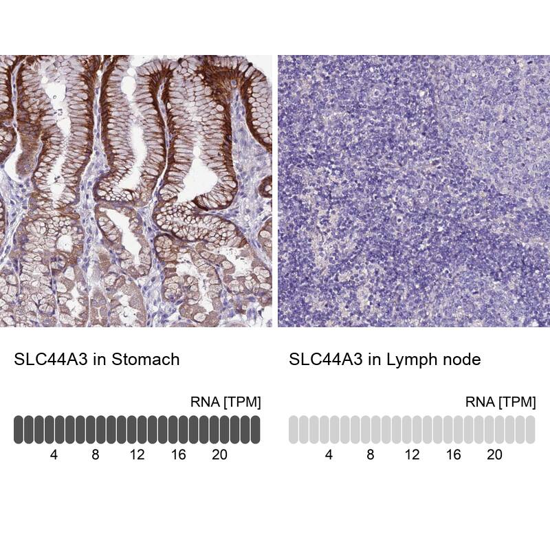 SLC44A3 Antibody - BSA Free Immunohistochemistry: SLC44A3 Antibody - BSA Free [NBP2-13339]