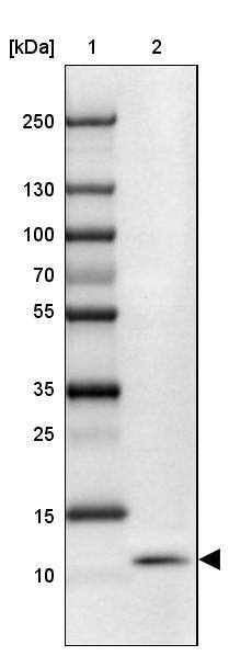 SLURP1 Antibody - BSA Free Western Blot: SLURP1 Antibody - BSA Free [NBP2-13351]
