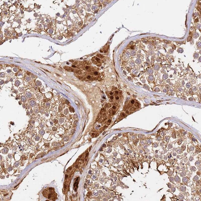 SMOX Antibody - BSA Free Immunohistochemistry: SMOX Antibody - BSA Free [NBP2-13356]