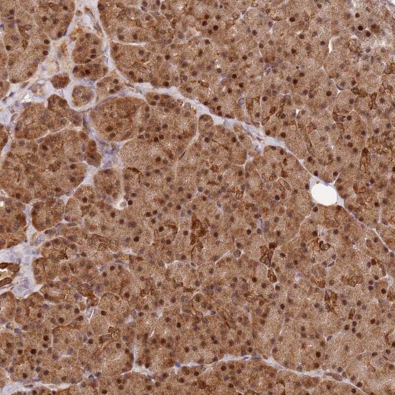 SMOX Antibody - BSA Free Immunohistochemistry: SMOX Antibody - BSA Free [NBP2-13356]