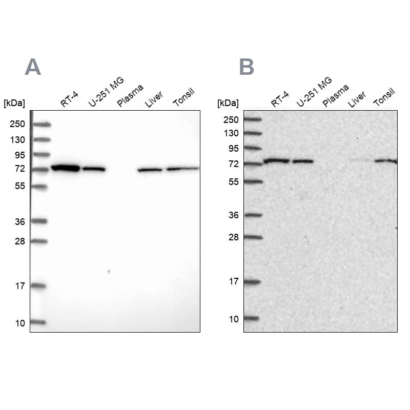 SNX1 Antibody - BSA Free Western Blot: SNX1 Antibody - BSA Free [NBP2-13359]