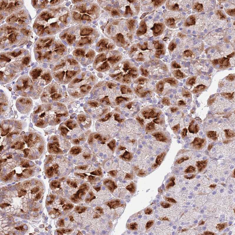 Snx6 Antibody - BSA Free Immunohistochemistry: Snx6 Antibody - BSA Free [NBP2-13361]