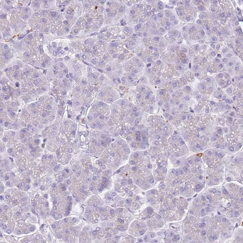 Snx6 Antibody - BSA Free Immunohistochemistry: Snx6 Antibody - BSA Free [NBP2-13361]