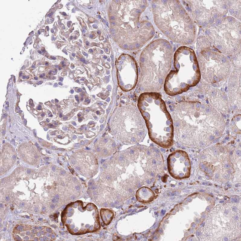 Snx6 Antibody - BSA Free Immunohistochemistry: Snx6 Antibody - BSA Free [NBP2-13361]