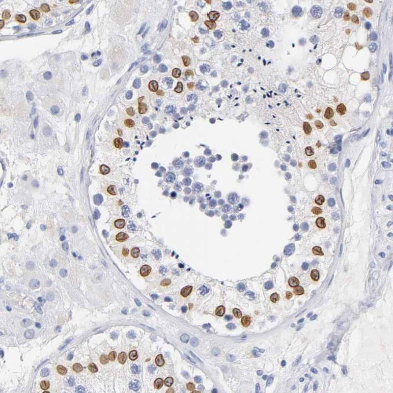 SOCS-7/Nck/NAP4 Antibody - BSA Free Immunohistochemistry: SOCS-7/Nck/NAP4 Antibody - BSA Free [NBP2-13363]