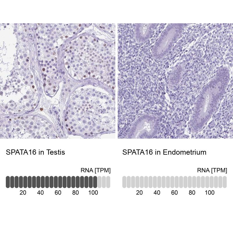 SPATA16 Antibody - BSA Free Immunohistochemistry: SPATA16 Antibody - BSA Free [NBP2-13368]