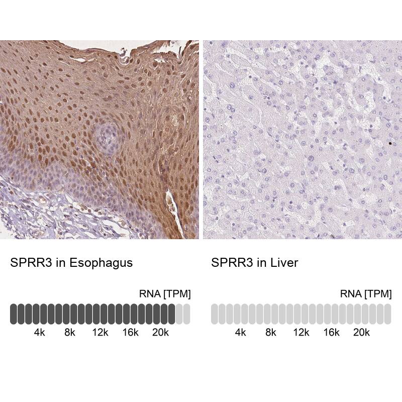 SPRR3 Antibody - BSA Free Immunohistochemistry: SPRR3 Antibody - BSA Free [NBP2-13374]